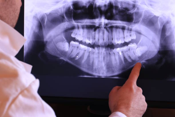 Best Broken Tooth Emergency  in Jericho, NY